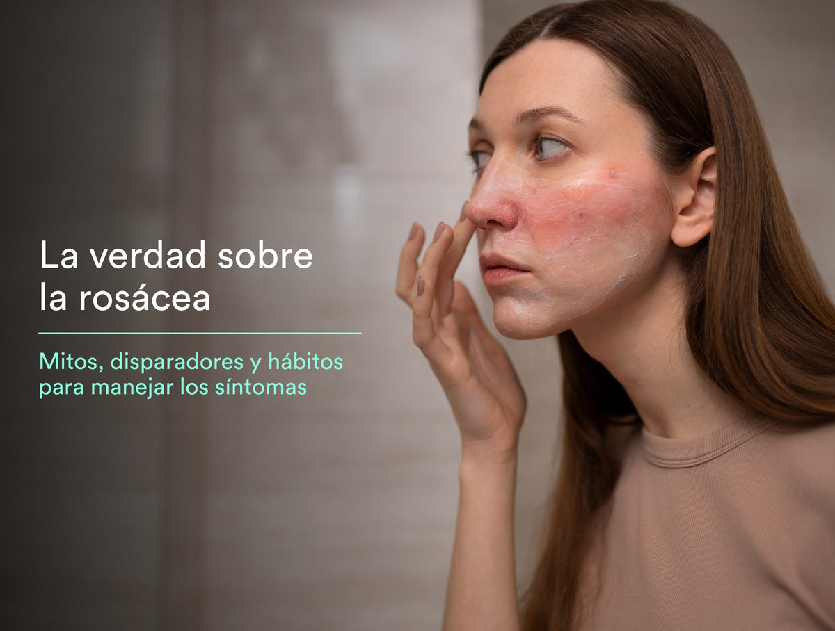 ¡No más rubor! Consejos para controlar los síntomas de la rosácea