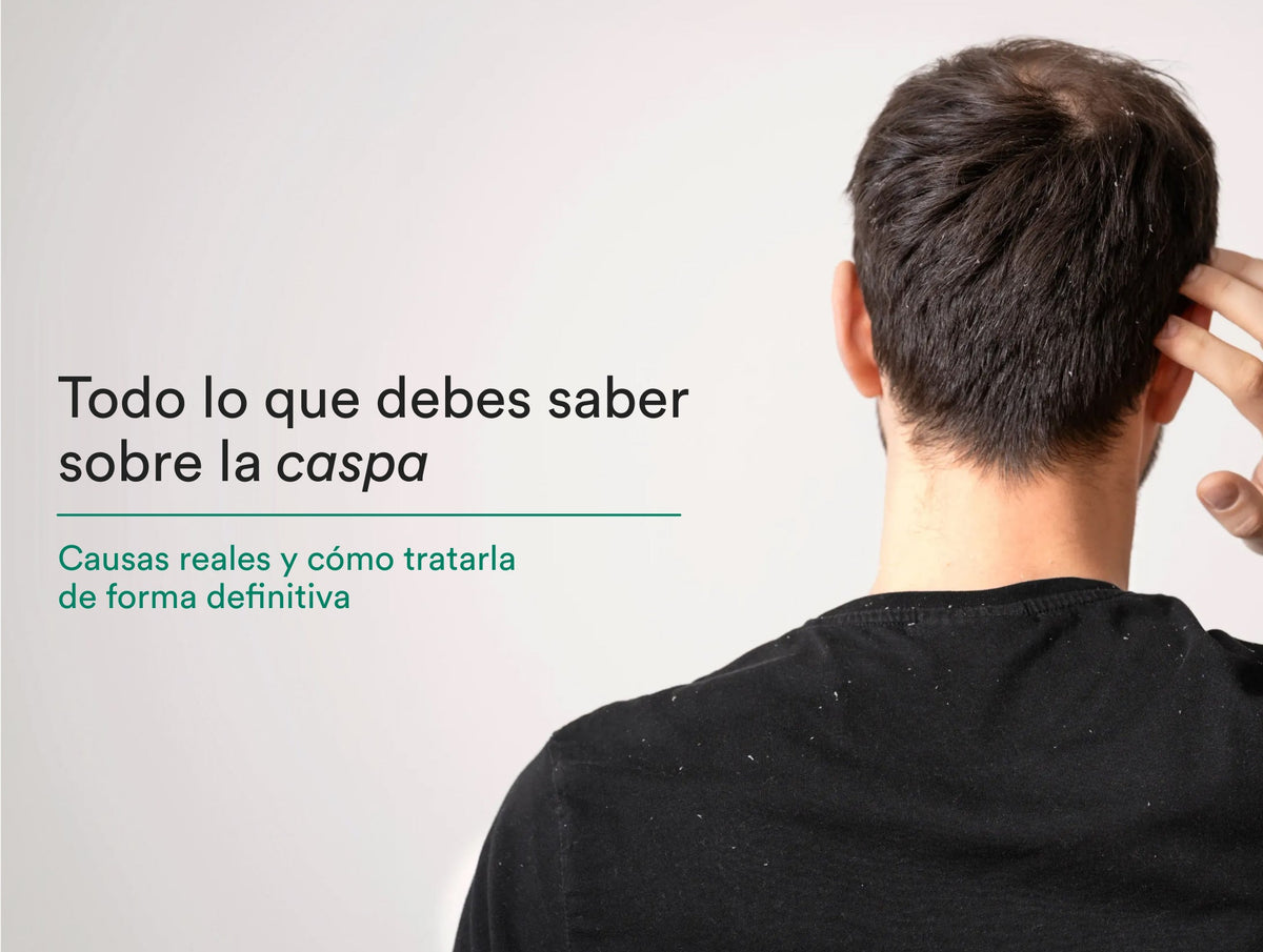 Qué es la caspa y cómo tratarla de verdad