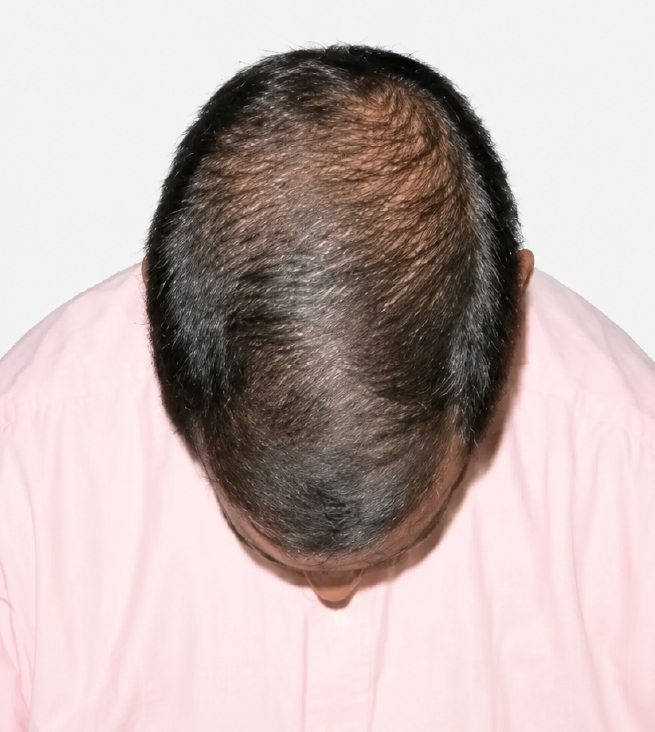Cabello después de usar la rutina Inbiotech