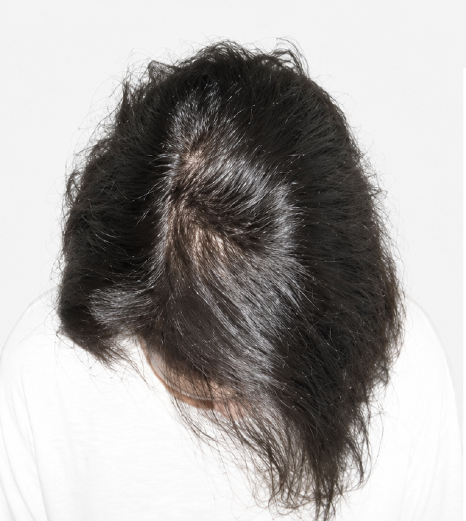 Cabello después de usar la rutina Inbiotech