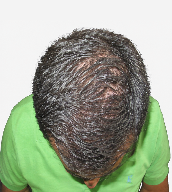Cabello después de usar la rutina Inbiotech