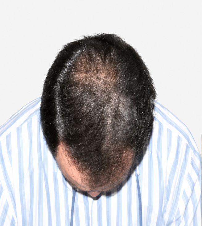 Cabello después de usar la rutina Inbiotech