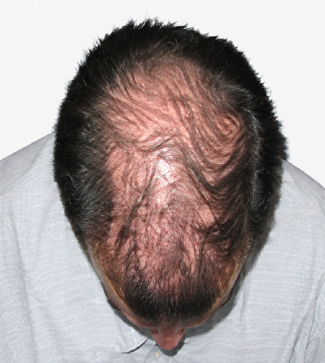 Cabello después de usar la rutina Inbiotech
