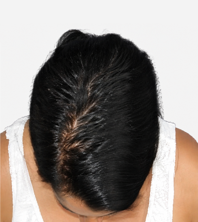 Cabello después de usar la rutina Inbiotech