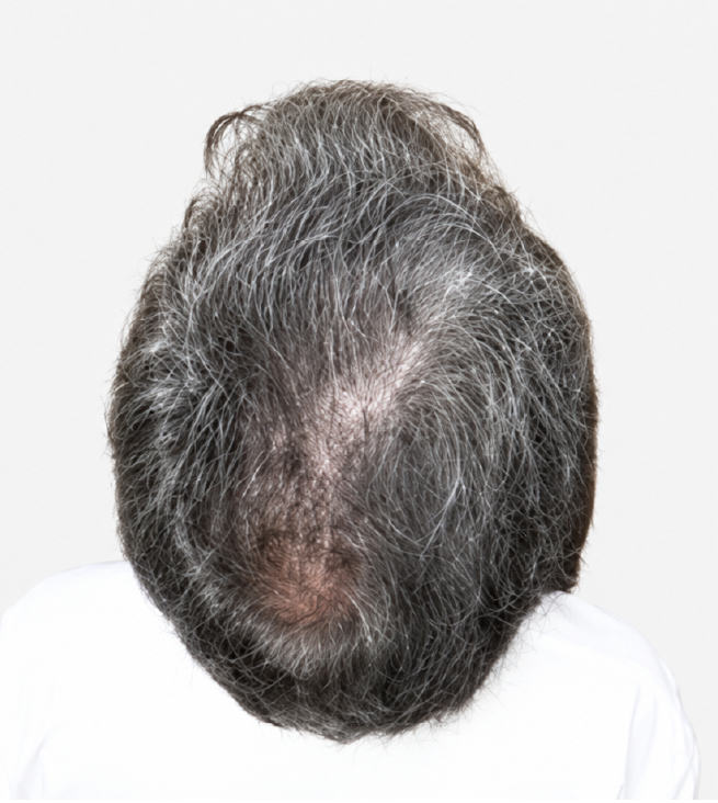 Cabello después de usar la rutina Inbiotech