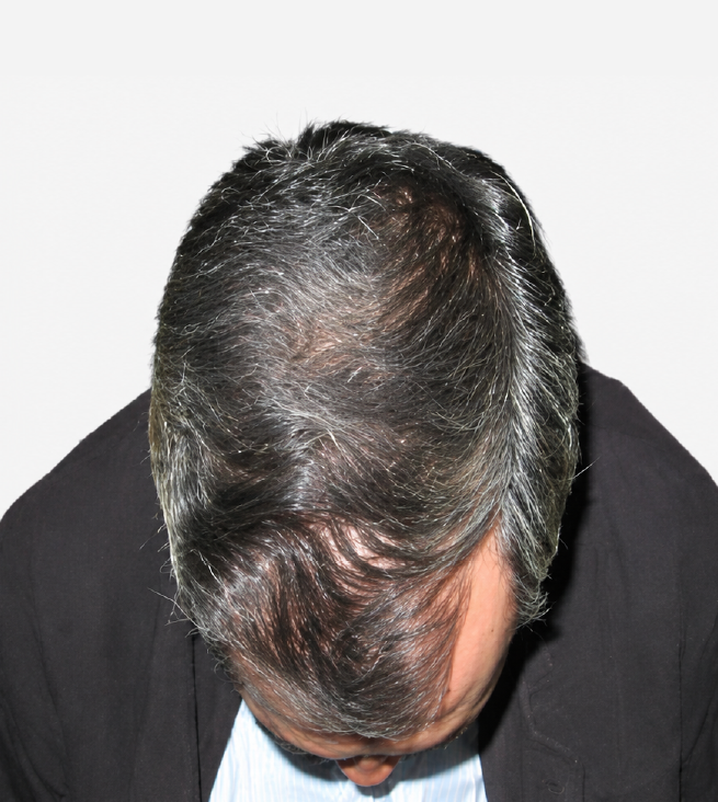 Cabello después de usar la rutina Inbiotech